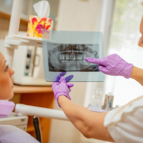 Dental Bonding Services to Fix Your Teeth