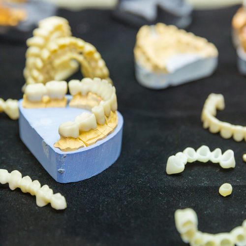 Dentures are removable bridges and replace missing teeth