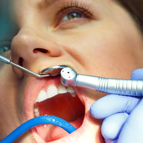 Periodontal disease is dangerous and requires immediate therapy