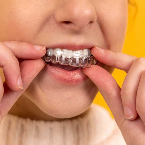 Invisalign Treatment in Coney Island NY with over 40 years of local expertise