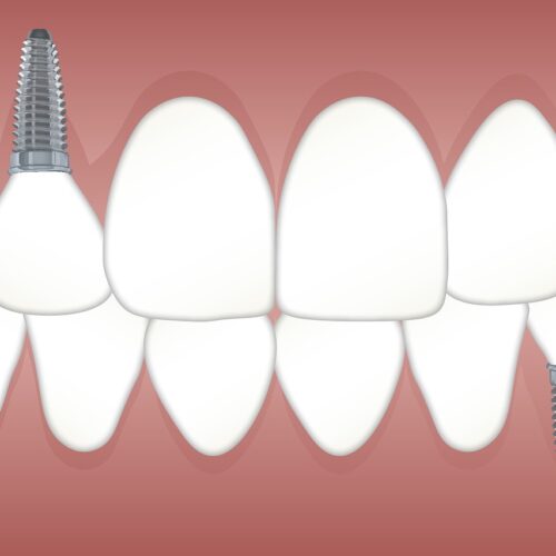 Find the right practice for Dental Implant Surgery Coney Island NY