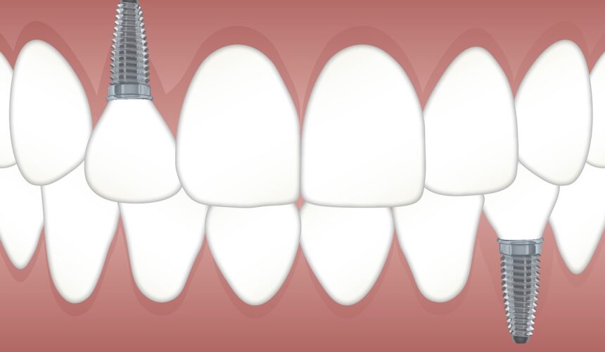 Find the right practice for Dental Implant Surgery Coney Island NY